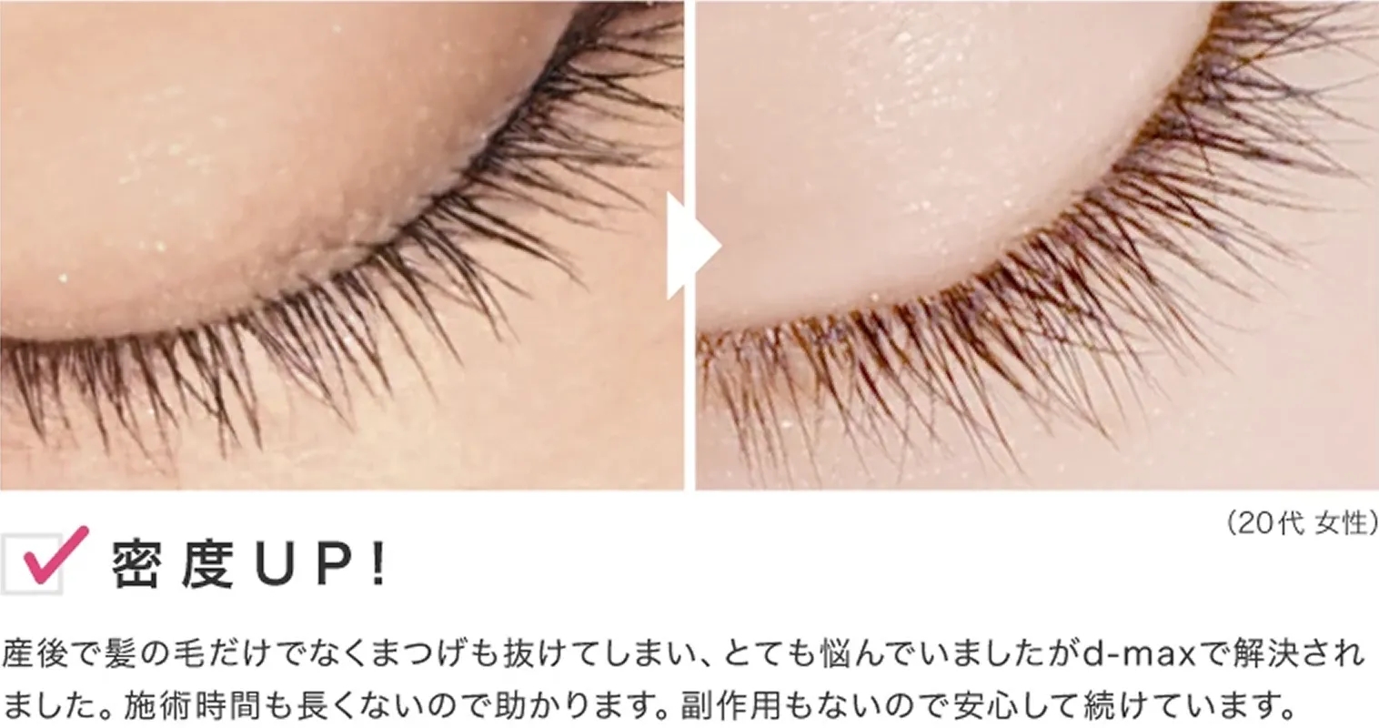 ビフォーアフター