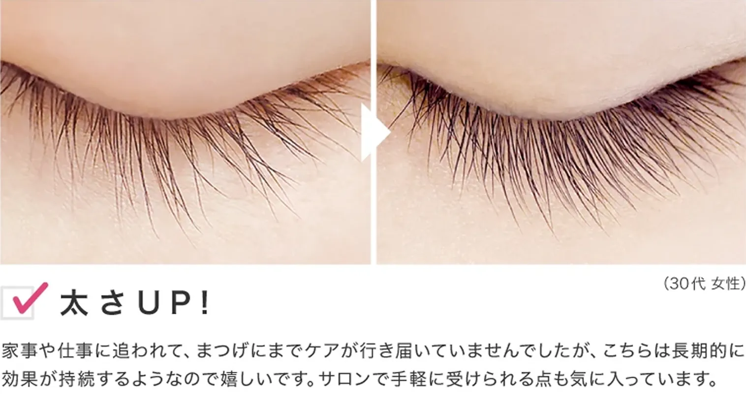 ビフォーアフター