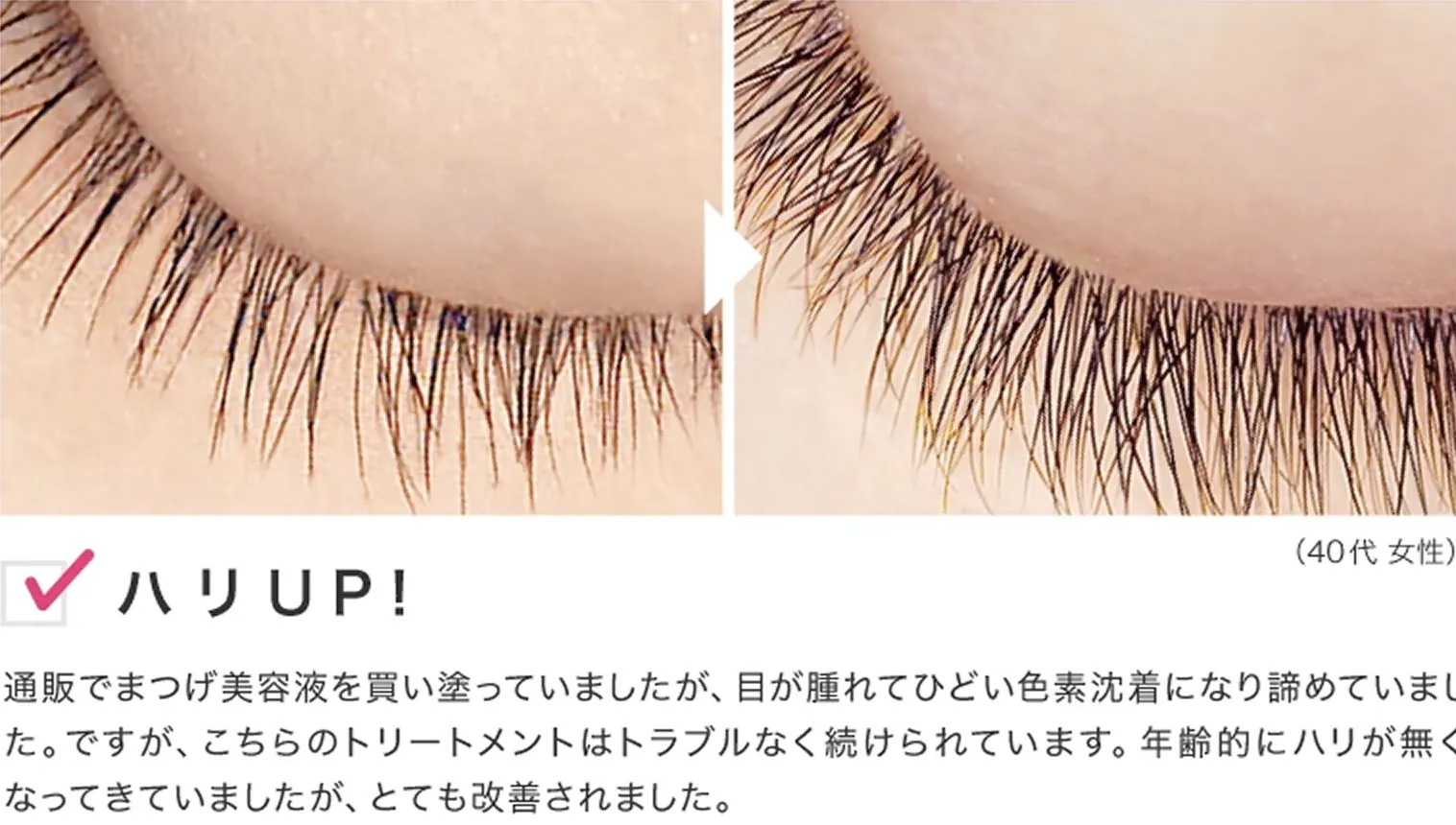 ビフォーアフター
