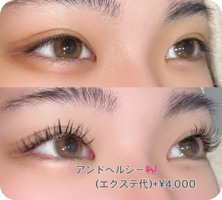 フラットラッシュ